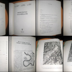 Carte Medicina-Nefropatiile Glomerulare Timisoara 1983. Stare foarte buna.