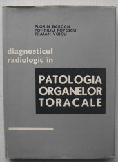 Barcan, Popescu, Voicu - Diagnosticul Radiologic In Patologia Organelor Toracale foto