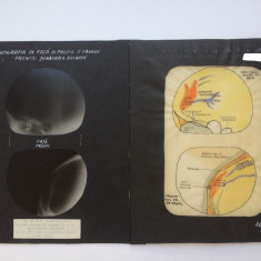 Radiografie veche