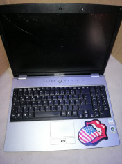 Laptop Medion Akoya MD96370 NETESTAT (L34) foto