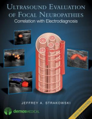 Ultrasound Evaluation of Focal Neuropathies: Correlation with Electrodiagnosis [With DVD] foto