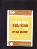 TUMORI BENIGNE SI MALIGNE