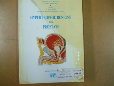 Hipertrofia benigna a prostatei Hypertrofie benigne de la prostate S. Khoury 005 foto