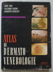 Conu, Coltoiu si Nicolescu - Atlas De Dermato-Venerologie foto