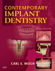 Contemporary Implant Dentistry - Editia 3 - Carl. E. Misch Engleza foto