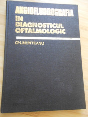 GH. MUNTEANU--ANGIOFLUOROGRAFIA IN DIAGNOSTICUL OFTALMOLOGIC foto