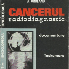 AS - A. Ordeanu - CANCERUL RADIODIAGNOSTIC DOCUMENTARE INDRUMARE VOLUMUL 2 1982