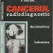 AS - A. Ordeanu - CANCERUL RADIODIAGNOSTIC DOCUMENTARE INDRUMARE VOLUMUL 2 1982