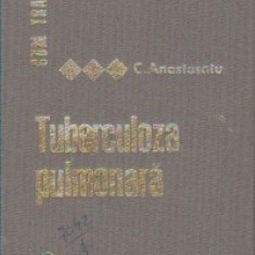 Cum tratam TUBERCULOZA PULMONARA de C.Anastasatu 1968,Carte medicina,T.POSTA