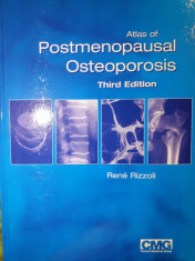 Atlas de osteoporoza foto