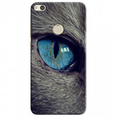 Husa Huawei P8 Lite 2017 / P9 Lite 2017 Custom Hard Case Cat Eye foto