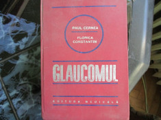 glaucomul paul cernea foto