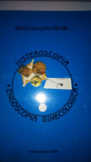 Histeroscopia - endoscopia ginecologica foto