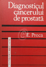 Diagnosticul cancerului de prostata foto