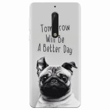 Husa silicon pentru Nokia 5, Tomorrow Will Be A Better Day Pug