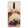 Husa silicon pentru Nokia 8, Love Pup
