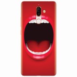 Husa silicon pentru Nokia 7 Plus, Big Mouth