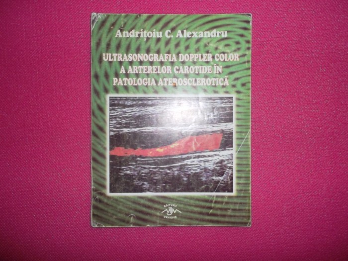 Andritoiu/Ultrasonografia doppler color
