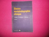 Electro encephalographie clinique/ J.Delay