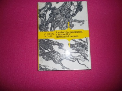 Anatomia Patologica A Tumorilor Sistemului Nervos De C. Arseni , N. Carp , 1978 foto