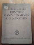 Cumpara ieftin TOTAL ROENTGEN RAY PHOTOS OF MAN - ROBERT JANKER,1934 / RARITATE !