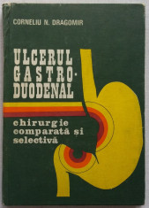 Corneliu N. Dragomir - Ulcerul Gastro-Duodenal. Chirurgie Comparata Si Selectiva foto