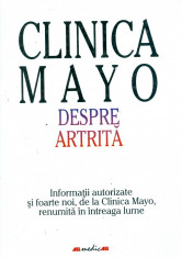 Clinica Mayo. Despre Artrita foto