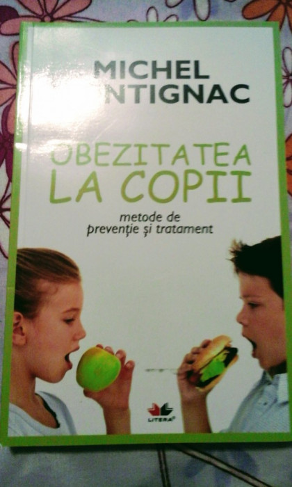 Obezitatea la copii, metode de prevenție și tratament, 240 pagini, 20 lei