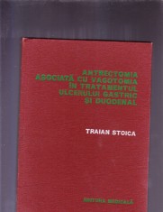 ANTRECTOMIA ASOCIATA CU VACOTOMIA IN TRATAMENTUL ULCERULUI GASTRIC SI DUODENAL