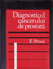 DIAGNOSTICUL CANCERULUI DE PROSTATA foto