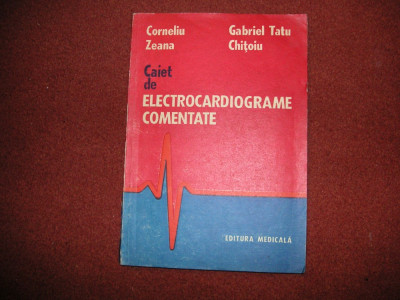 Caiet de electrocardiograme comentate ~ Corneliu Zeana foto