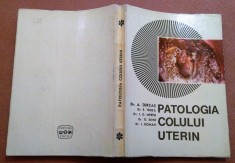 Patologia Colului Uterin - A. Turcas, E. Truta, I. D. Merfu, G. Simu, I. Roman foto