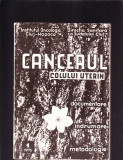 CANCERUL COLULUI UTERIN, 1976