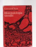 HISTOPATOLOGIA TIROIDEI