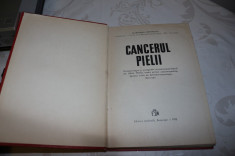 Alexandru Dimitrescu - Cancerul Pielii - editura medicala 1975 foto