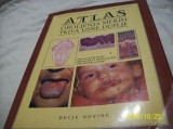 Atlas oboljenja mekih tkiva usne duplje limba sarba an 1989