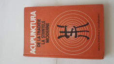 ACUPUNCTURA - DE LA TRADITIE LA STIINTELE MODERNE foto