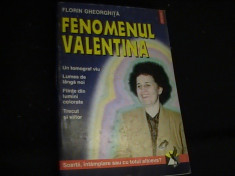 FENOMENUL VALENTINA-FLORIN GHERORGHITA-UN TOMOGRAF VIU- foto