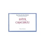 Evită cancerul! - Paperback brosat - Prof. Dr. Pavel Chirilă - Christiana