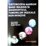Cistoscopia narrow band imaging in diagnosticul tumorilor vezicale non-invazive - Marian Jecu, Bogdan Geavlete