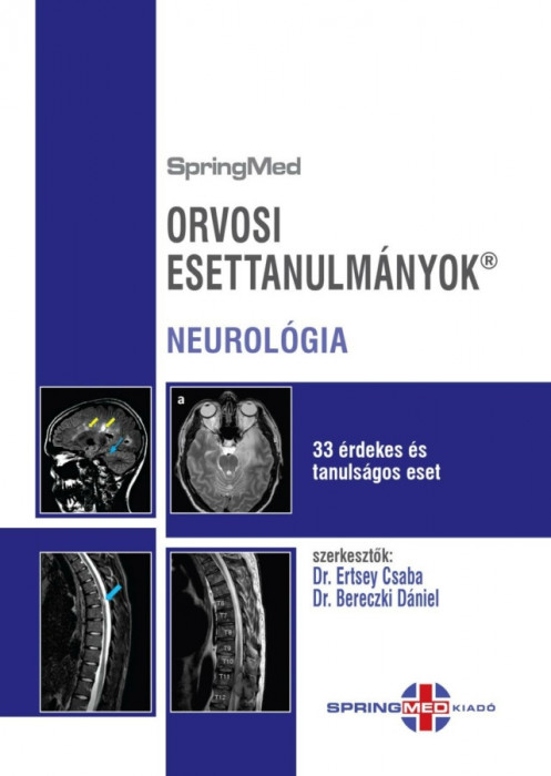 Orvosi esettanulm&aacute;nyok - Neurol&oacute;gia - 33 &eacute;rdekes &eacute;s tanuls&aacute;gos eset - Prof. Dr. Bereczki D&aacute;niel