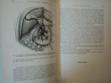CHIRURGIA CAILOR BILIARE EXTRAHEPATICE de I. TURAI, D. GEROTA 1957