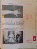 Laserterapie si Chirurgie Laser in Dermatologie, 2000, Ilustratii - Carte de Anatomie, Dermatologie