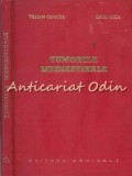 Tumori Mediastinale - Traian Oancea, Liviu Hica, Studiu Anatomoclinic, Editura Medicala 1971, Carte Medicina Romana
