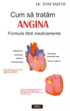 Cum să tratăm angina - Paperback brosat - Tom Rob Smith - Antet Revolution