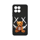 Husa BestCase&reg; Premium Silicon, Compatibila Cu Honor X8 5G, 1.2MM Slim, Teddy