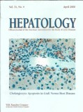 Cumpara ieftin Hepatology - Official journal of the American Association for the study of liver diseases - April 200