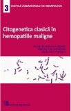 Citogenetica clasica in hemopatiile maligne - Nicoleta Mariana Berbec