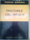 Nicolae Burghele - Fracturile calcaneului (1978)