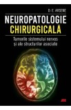 Neuropatologie chirurgicala. Tumorile sistemului nervos - Dr. Dorel Eugen Arsene
